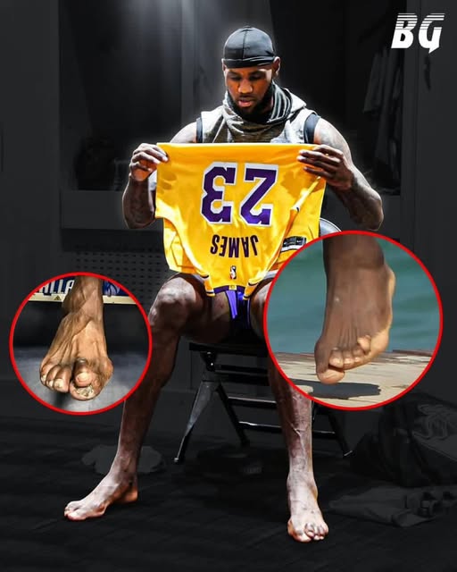 The Million-Dollar Foot Industry and why pro athletes are ditching it