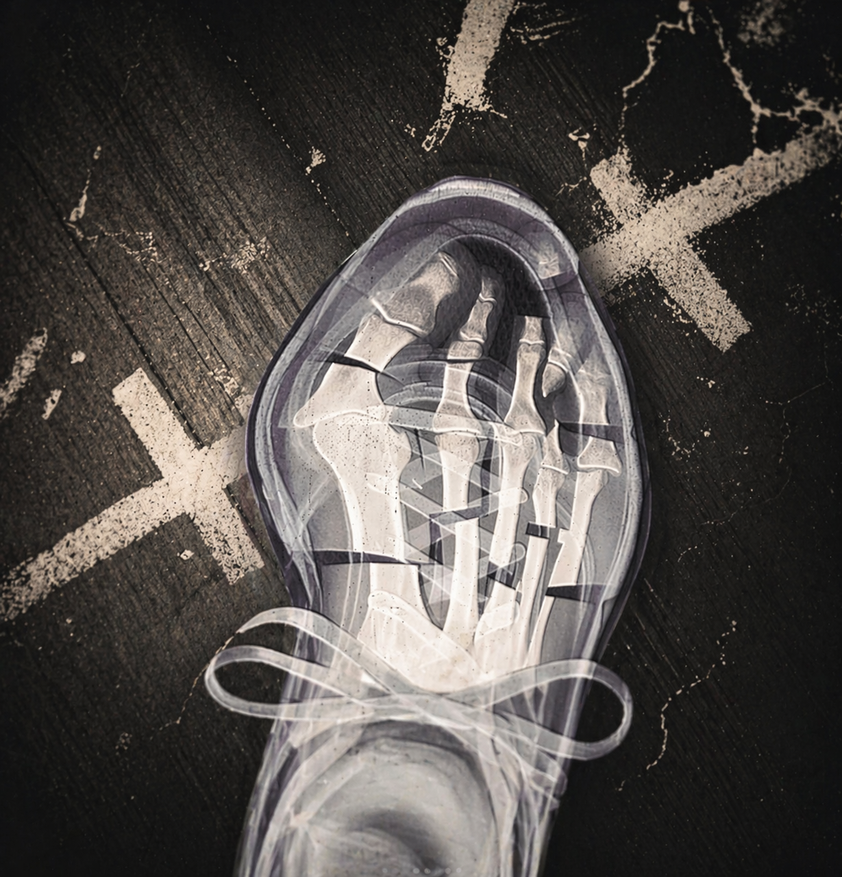 Your Feet Just Did a Hyrox. Here's What They're Trying to Tell You.