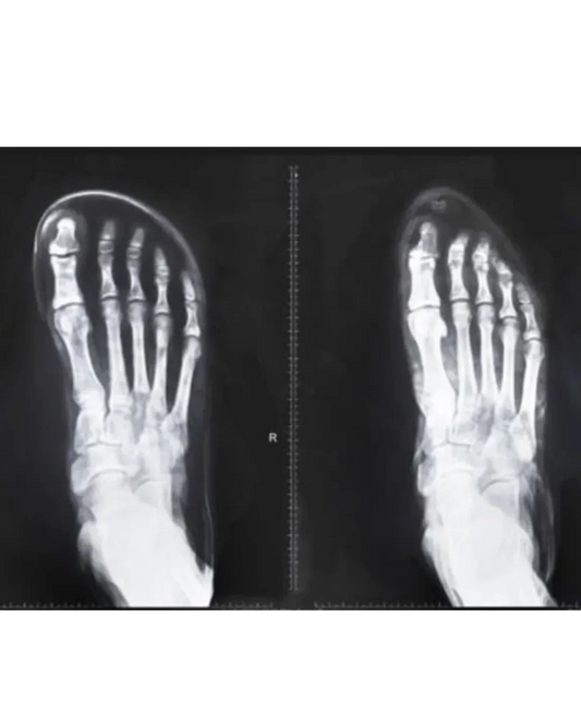 traditional shoes vs barefoot shoes